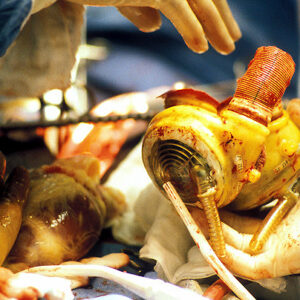 دندانپزشک آهنین با قلبی از آلومینیوم!