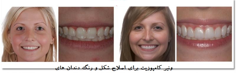سریعترین راه رسیدن به لبخند زیبا چیست؟