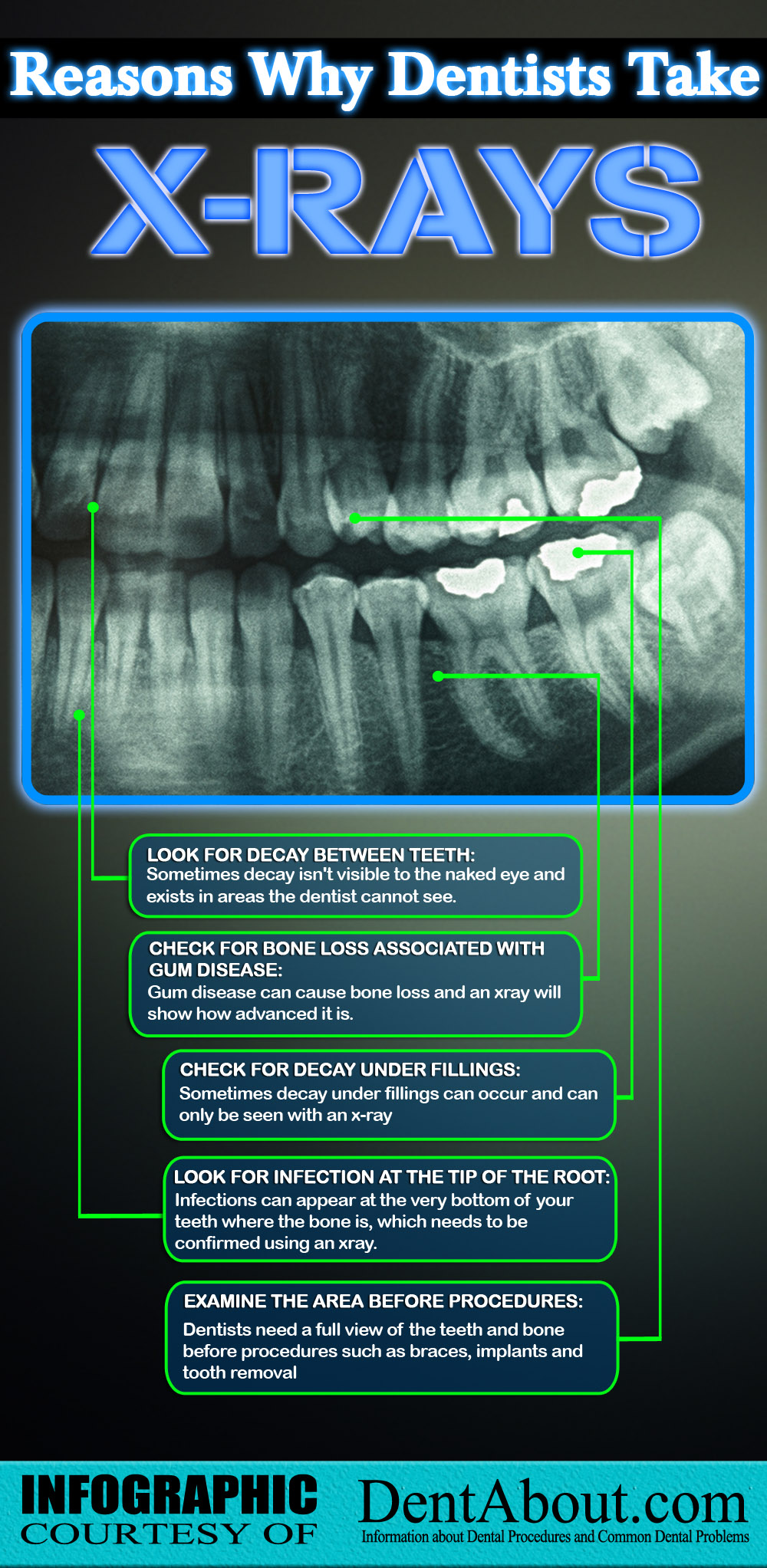 اینفوگراف/ ۵کاربرد عکس رادیوگرافی در دندانپزشکی
